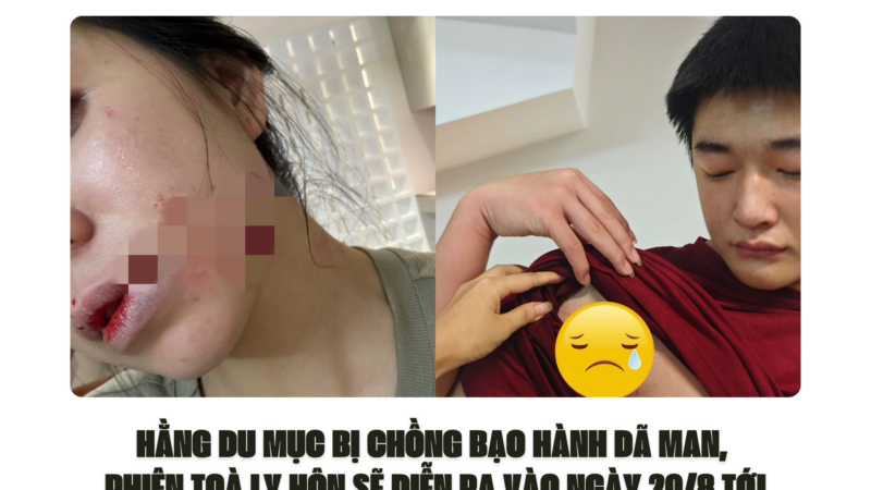 HẰNG DU MỤC BỊ CHỒNG BẠO HÀNH DÃ MAN, PHIÊN TOÀ LY HÔN SẼ DIỄN RA VÀO NGÀY 20/8 TỚI