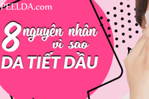 Cách Làm Hết Da Dầu 2