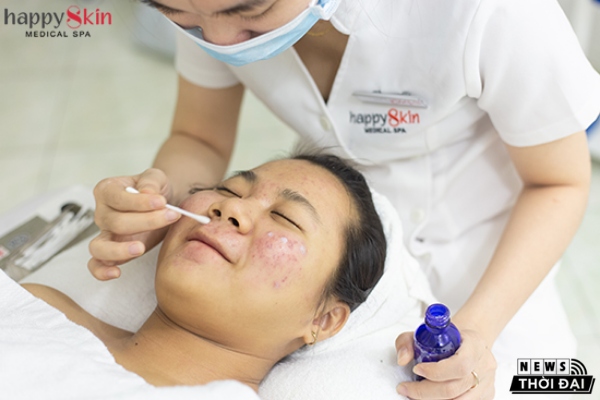 khách hàng nặn mụn tại Happy Skin Medical Spa