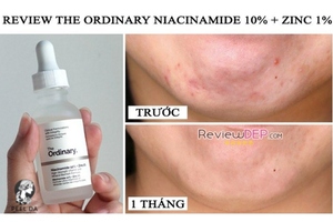 tinh chất niacinamide 10 + zinc 1 - The Ordinary 2