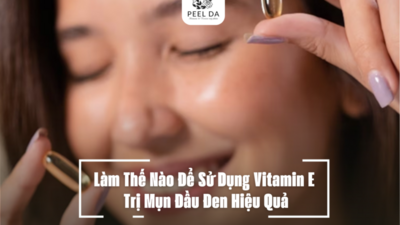 Làm Thế Nào Để Sử Dụng Vitamin E Trị Mụn Đầu Đen Hiệu Quả