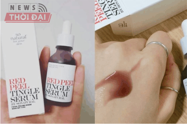 Review Peel Da Bằng Red Peel Tingle Serum Hàn Quốc